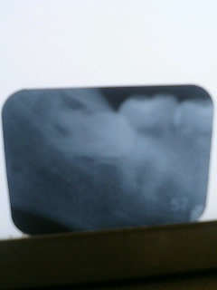 c0026846_11352017.jpg