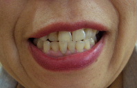 d0064175_22222729.jpg