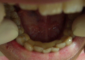d0064175_1905171.jpg