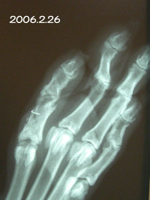 f0025769_2024114.jpg