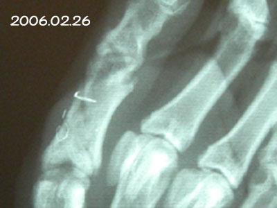 f0025769_2024544.jpg