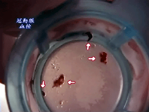 a0055913_8465497.gif
