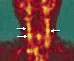 a0055913_8475747.gif
