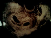 c0109970_20111180.jpg