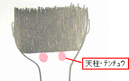 e0118683_20472564.gif