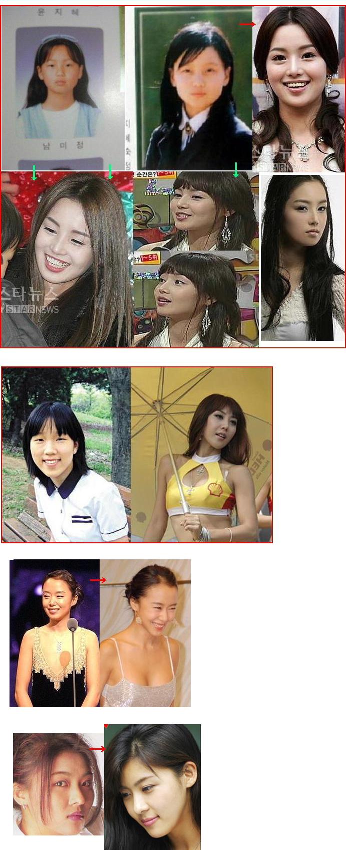 整形を告白した芸能人、有名人YouTube動画>5本 ->画像>75枚 