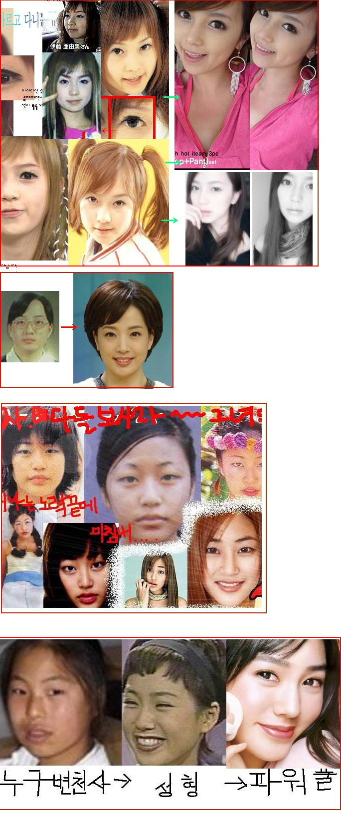 整形を告白した芸能人、有名人YouTube動画>5本 ->画像>75枚 