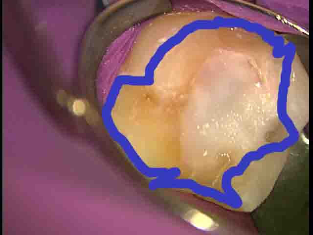 e0004468_654230.jpg