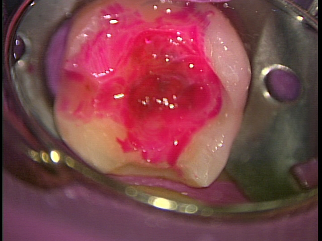 e0004468_7292523.jpg