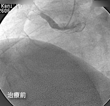 a0055913_012526.gif