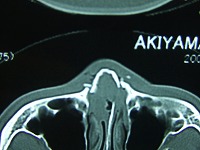 d0024216_02661.jpg
