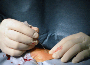 a0055913_16123986.gif
