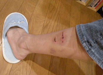 e0066883_20531997.gif