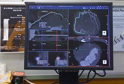 a0055913_2051401.gif