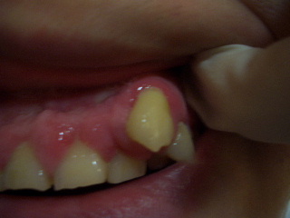 d0064175_96129.jpg