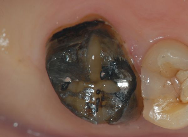 e0004468_8484942.jpg