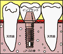 f0130024_11275833.jpg
