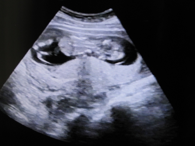 c0062495_16223567.jpg