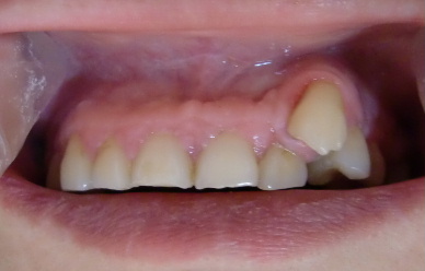d0064175_9362780.jpg
