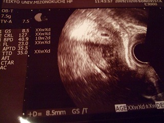 c0162005_22435345.jpg