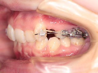 c0193833_2346620.jpg