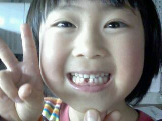 f0031013_18212186.jpg
