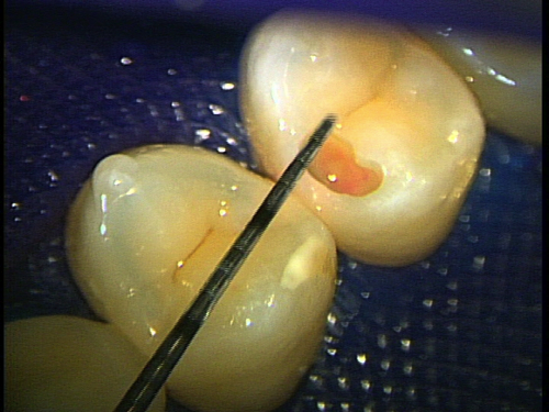 e0004468_1940247.jpg