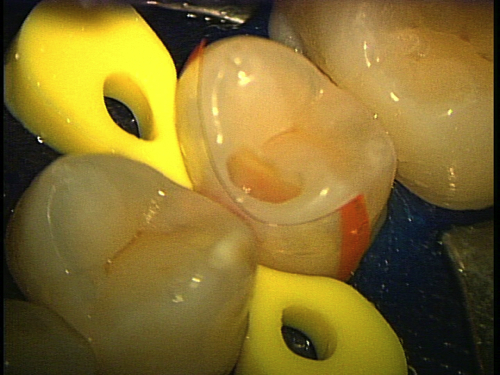 e0004468_196068.jpg