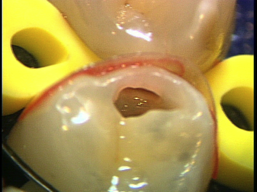 e0004468_19673.jpg
