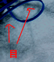 e0103408_8275878.gif