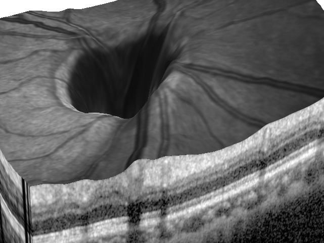 f0088231_2238434.jpg