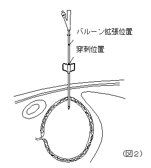 f0129786_1261592.jpg