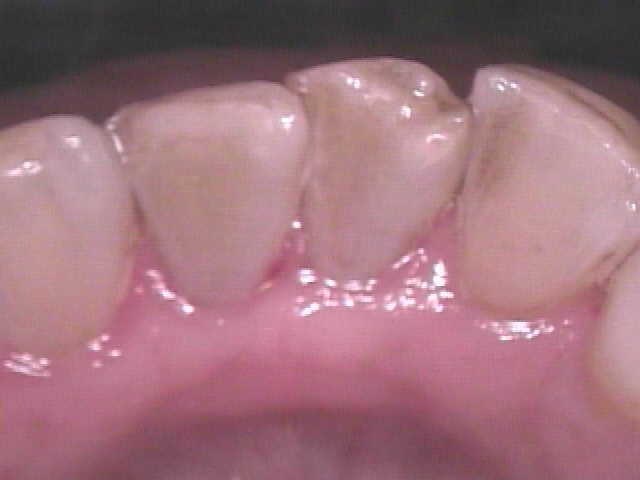 d0159325_12515768.jpg
