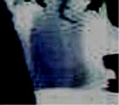 e0103408_15385665.gif