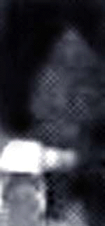 e0103408_14302935.gif