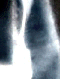 e0103408_1451474.gif