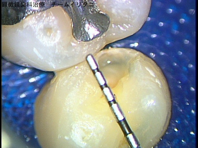 e0004468_143254.jpg