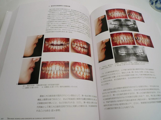 矯正臨床の基礎