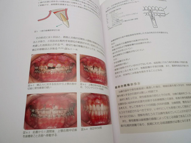 矯正臨床の基礎