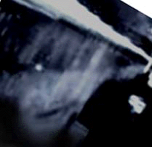 e0103408_1514416.gif