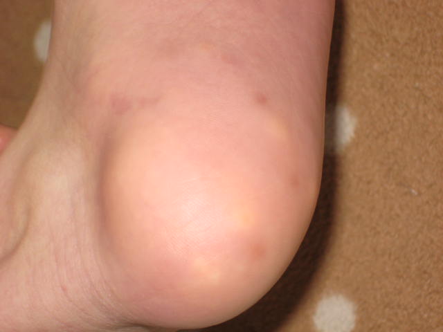 e0166032_16292756.jpg