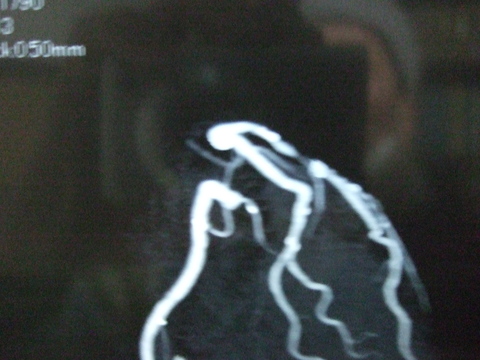 e0009760_14371510.jpg