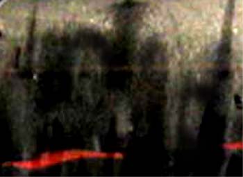 e0103408_7311628.jpg