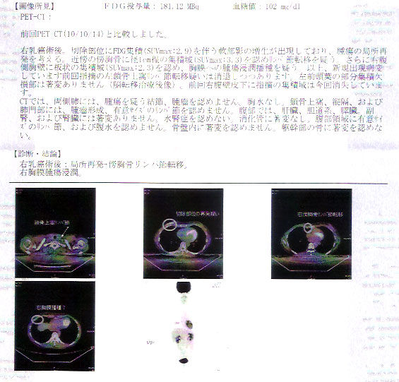 e0034047_16232150.jpg