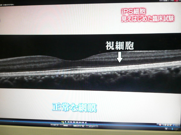 b0118987_1711499.jpg