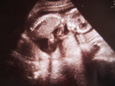 d0158258_1334208.jpg