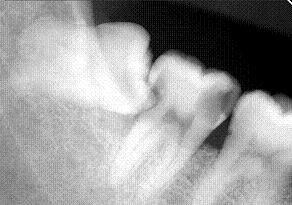 e0048994_16531070.jpg