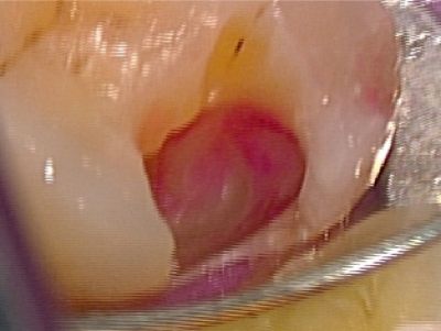 e0004468_725623.jpg