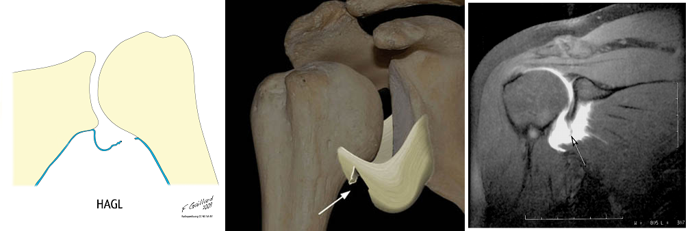 b0112009_1532976.png