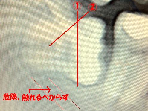 a0167341_18174319.jpg